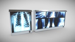 xray screens theatre, mri, hospital, xray, x-ray, operating, x-ray-scan, hospital-equipment, substancepainter, substance, scan, screen, xrays, operating-room, theatre-room