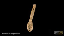 Right Arm Pronator Quadratus anatomy, muscle, pronator, quadratus, bones