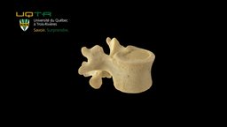 Vertèbre lombale / Lumbar vertebra 