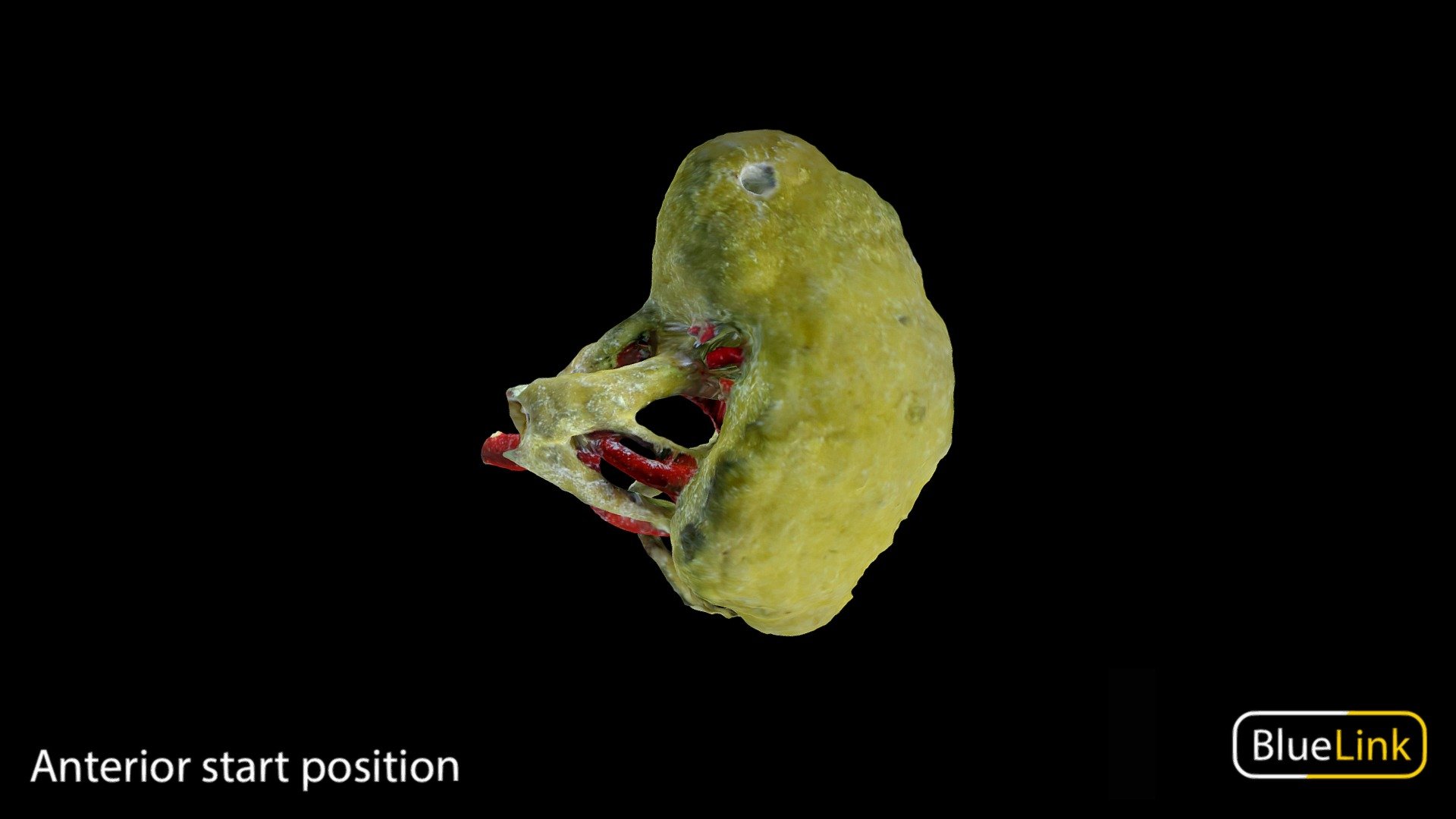 Whole kidney colored yellow

Captured with photogrammetry

Captured and edited by: Nikita Shishu

Copyright 2022 BK Alsup &amp; GM Fox

32501-A02 - Whole Kidney- Left - 3D model by Bluelink Anatomy - University of Michigan (@bluelinkanatomy) 3d model
