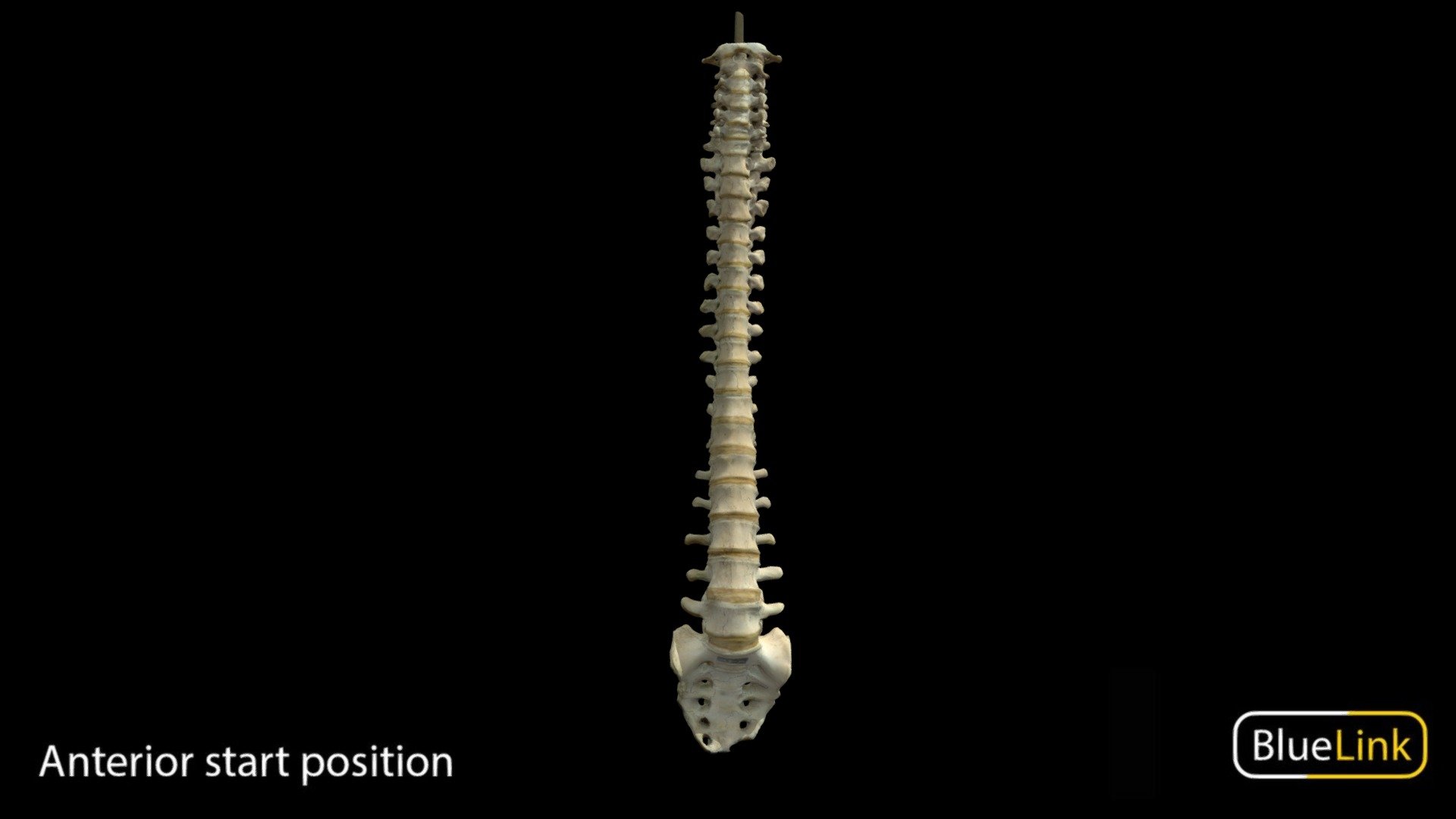 3D scan of a fixed, full spinal column

Captured with Einscan Pro

Captured and edited by: Will Gribbin

Copyright2019 BK Alsup &amp; GM Fox - Spinal Column - 3D model by Bluelink Anatomy - University of Michigan (@bluelinkanatomy) 3d model