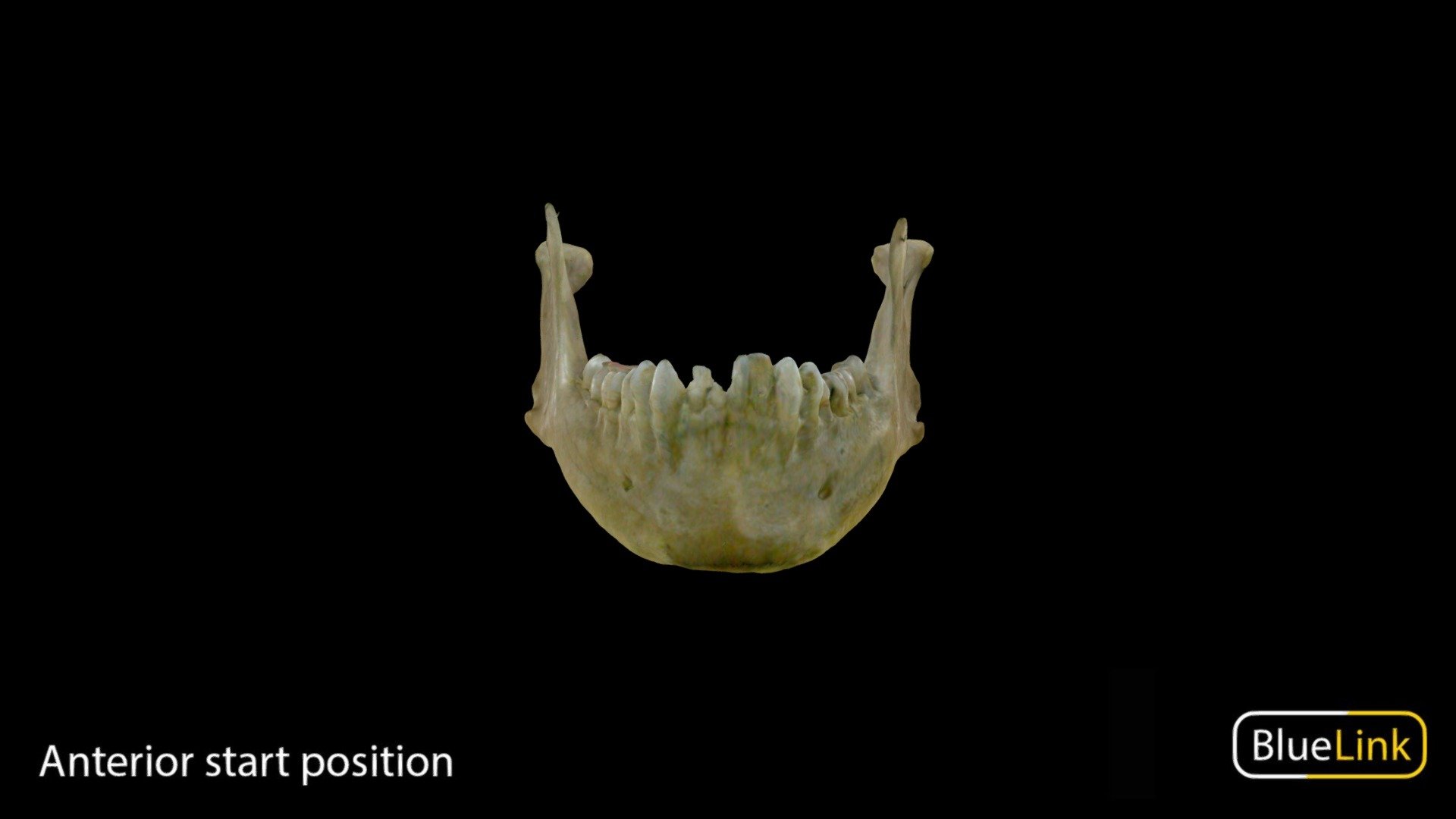 Human mandible

Captured with: Einscan Pro

Captured and edited by: Cristina Prall

University of Michigan

CC B. Kathleen Alsup and Glenn M. Fox - Mandible - 3D model by Bluelink Anatomy - University of Michigan (@bluelinkanatomy) 3d model