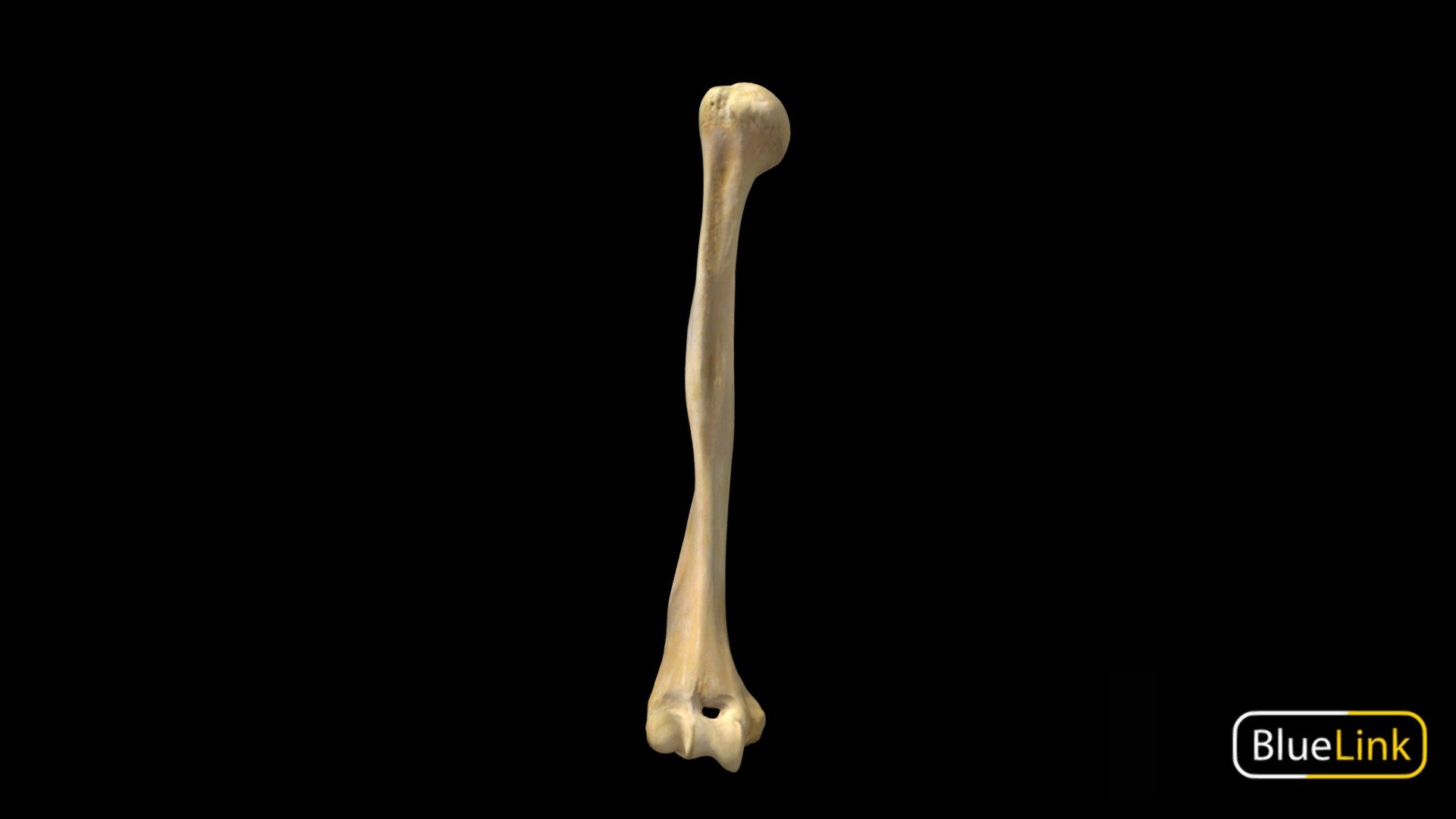 3D scan of the right humerus

Captured with Einscan Pro

Captured and edited by: Madelyn Murphy

Copyright2019 BK Alsup &amp; GM Fox - Humerus - Right, Labeled - 3D model by Bluelink Anatomy - University of Michigan (@bluelinkanatomy) 3d model
