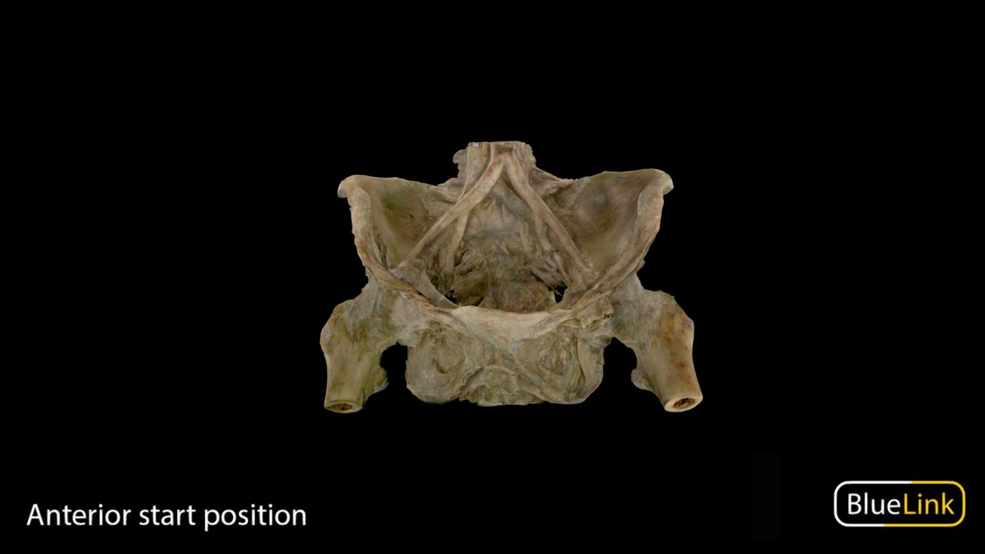 3D scan of pelvis with muscles removed; coronal section of penis

Captured with Einscan Pro

Captured and edited by: Will Gribbin

Copyright2019 BK Alsup &amp; GM Fox

ID 29207-P01 - Skeletonized Pelvis - 3D model by Bluelink Anatomy - University of Michigan (@bluelinkanatomy) 3d model