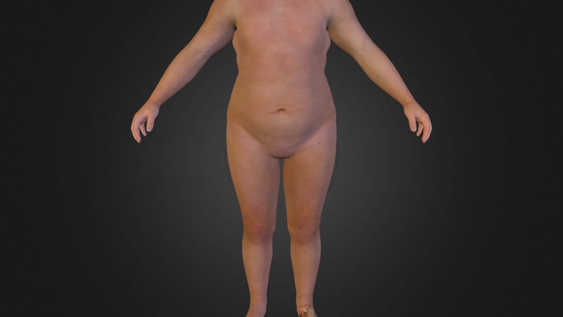 Body Fat - 3D model by drcidbaez 3d model