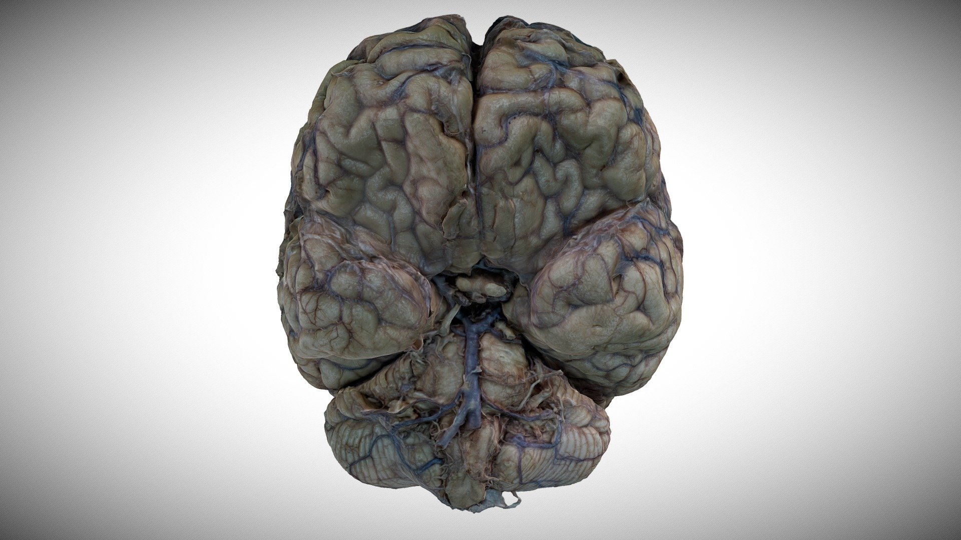 Whole brain photogrammetry scan of human brain specimen with arachnoid membrane preserved - 1- Human brain with arachnoid - 3D model by Manuscript submission (@tspiriev) 3d model