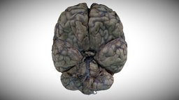 1- Human brain with arachnoid