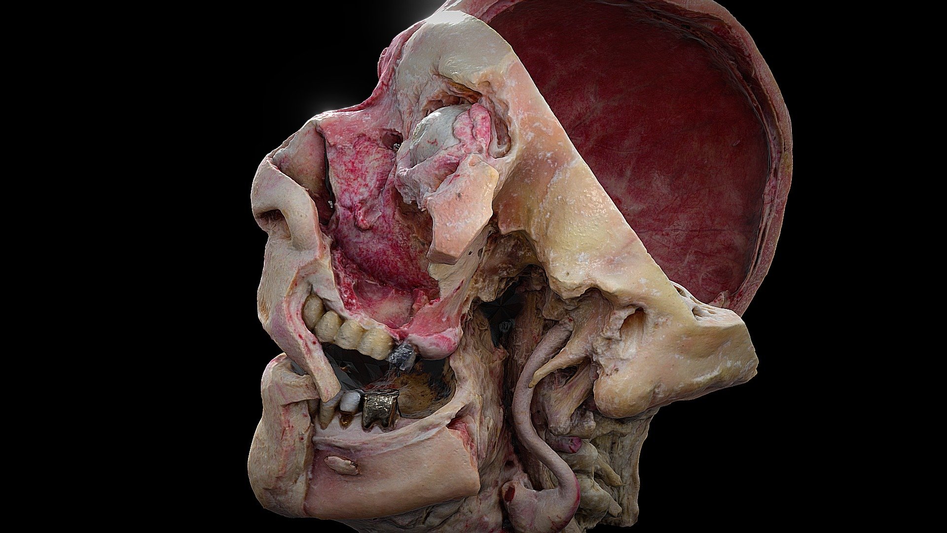 Maxillary Sinus & Lacrimal gland - 3D model by John A Burns School of Medicine (@jabsom) 3d model
