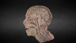 Corte sagital de cabeza/Sagittal head section pont, anatomy, brain, bone, puente, ventricle, anatomia, tronco, cerebellum, gyrus, sulcus, neuroanatomy, callosum, brainstem, midbrain, cerebro, diencephalon, sagittal, sagital, cerebelo, diencefalo, ventriculo, neuroanatomia, culliculus, calcarine, cingulate, encefalico, mesencefalo, cuneus
