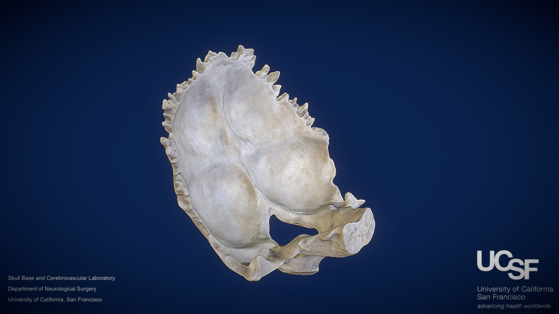 Volumetric model of occipital bone, with annotations of the main structures.

We would like to acknowledge Eric Bauer for facilitating the base mesh used to described the anatomical concepts in this model.
Original Mesh:https://sketchfab.com/3d-models/human-occipital-bone-dd3e27f4079f43bab063e3db26c4482c

Immersive Surgical Anatomy of the Craniocervical Junction Article:
https://www.cureus.com/articles/40530-immersive-surgical-anatomy-of-the-craniocervical-junction#article-disclosures-acknowledgements - Model 1: Occipital Bone - 3D model by SBCVL_UCSF 3d model