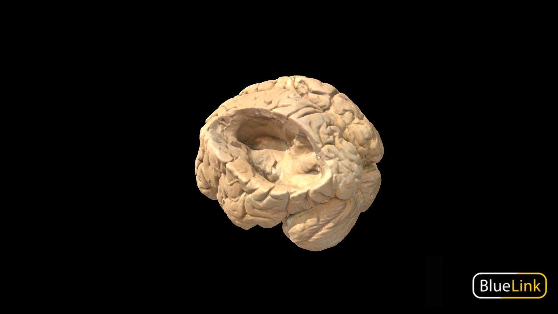 3D scan of the brain with section cut out to display the hippocampus

Captured with Einscan Pro

Captured and edited by: Madelyn Murphy, Cristina Prall

Copyright2019 BK Alsup &amp; GM Fox - Brain - Lateral Ventricle, Labeled - 3D model by Bluelink Anatomy - University of Michigan (@bluelinkanatomy) 3d model