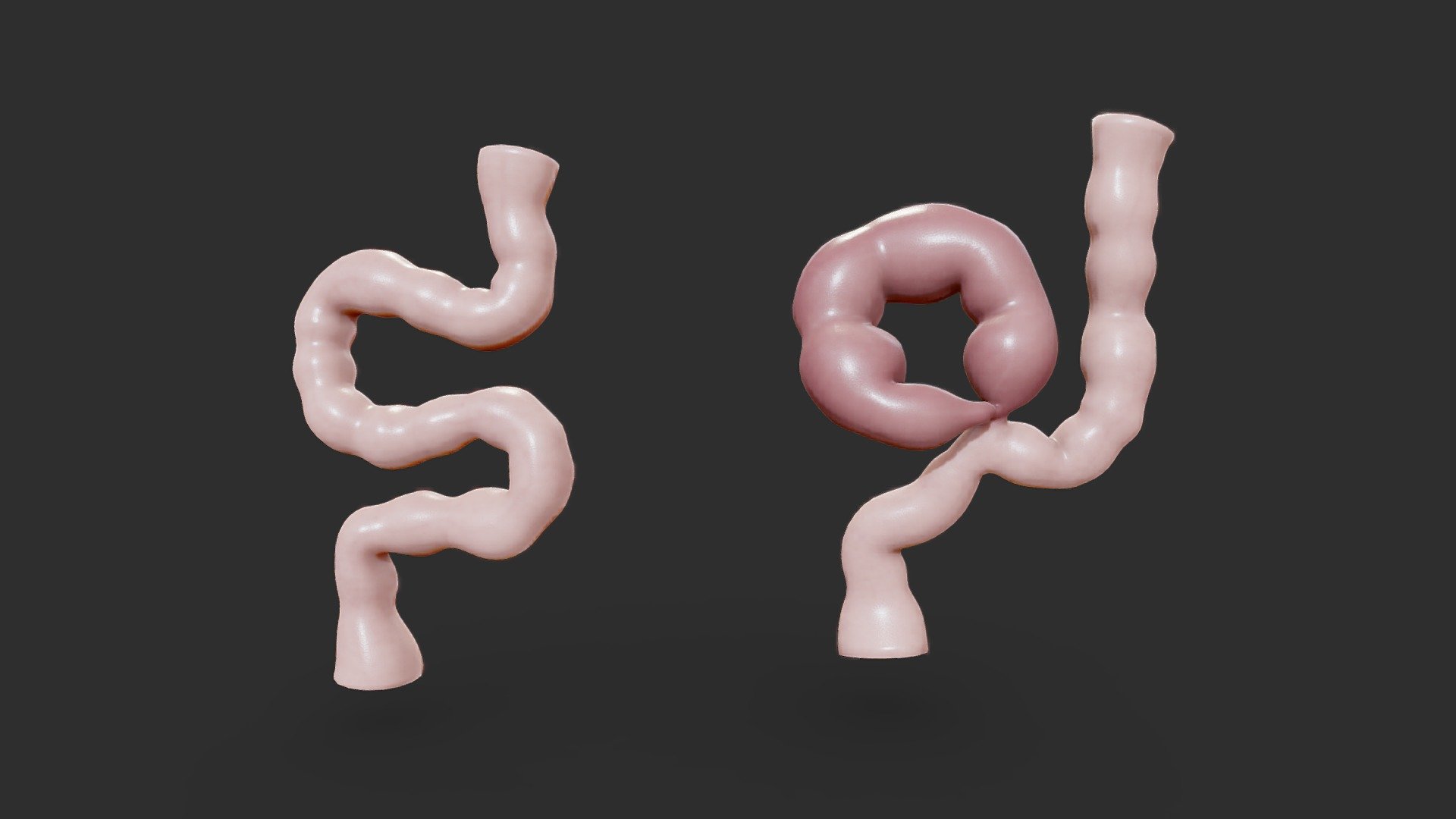 Volvulus of the Colon

A volvulus is when a loop of intestine twists around itself and the mesentery that supports it, resulting in a bowel obstruction. Symptoms include abdominal pain, abdominal bloating, vomiting, constipation, and bloody stool.




Format: FBX, OBJ, MTL, glb, glft, STL, Blender v3.4.1

Optimized UVs (Non-Overlapping UVs)

Two separate formats for textures (4k) (PBR) ( Jpeg and Png)

Base Color (Albedo)

Normal Map

AO Map

Metallic Map

Roughness Map

Height Map

Render scene in Blender

 - Volvulus of the Colon - Buy Royalty Free 3D model by Nima (@h3ydari96) 3d model