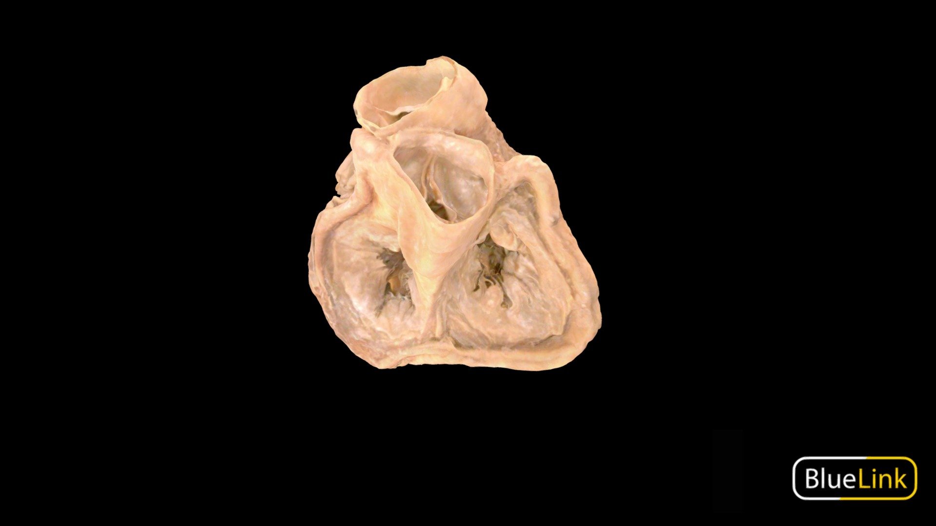 Human heart with atria removed to show heart valves
Captured with: Einscan Pro
Captured by: Will Gribbin
Edited by: Cristina Prall
University of Michigan
25981-C01 - Heart Valves - Labeled - 3D model by Bluelink Anatomy - University of Michigan (@bluelinkanatomy) 3d model