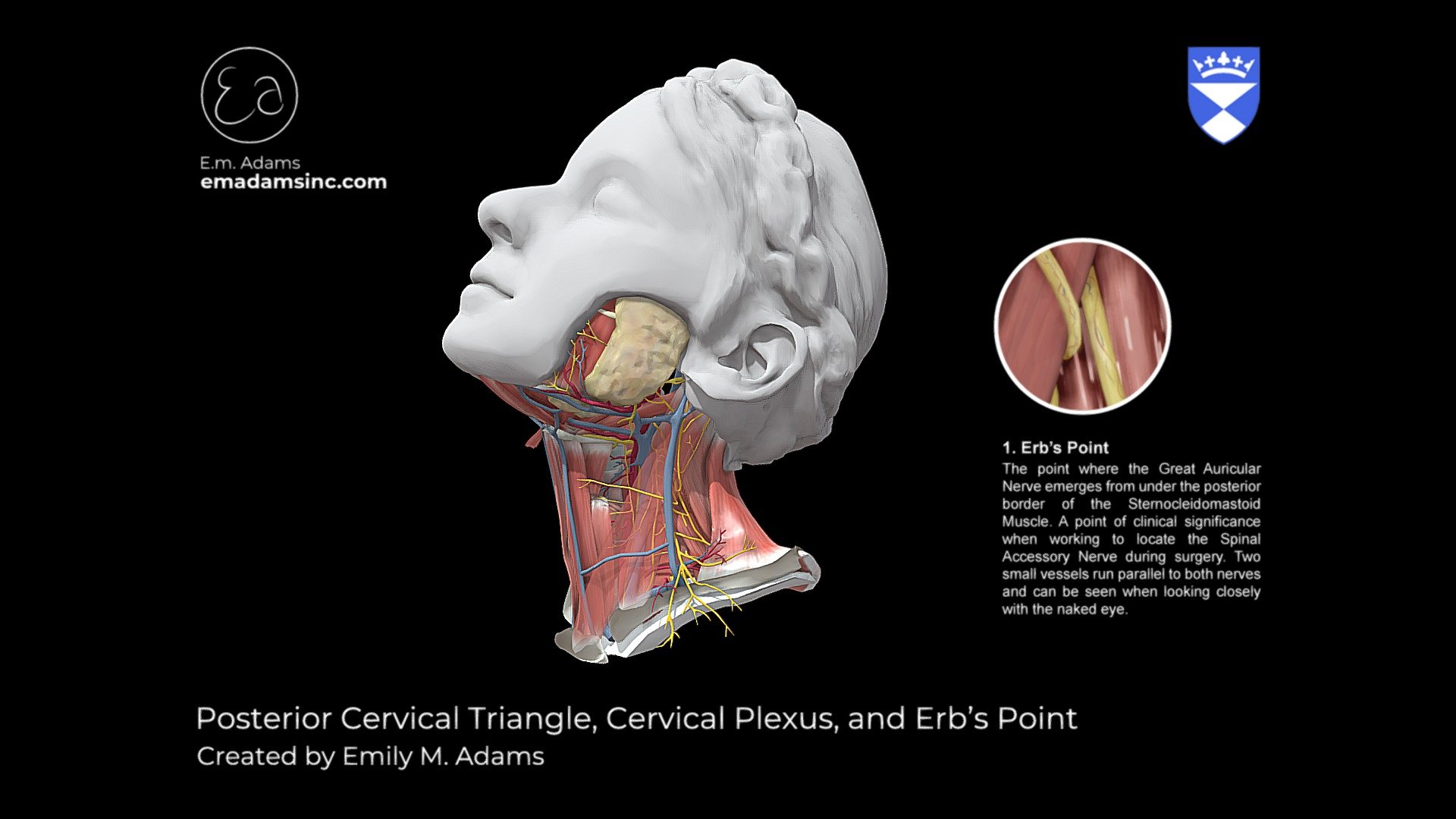 Depicts the major structures of the posterior cervical triangle and the nerves that arise from the cervical plexus as well as Erb's point a major clinical marker for head and neck surgery and dissection. One side has the sternocleidomastoid muscle retracted showing the nerves deep to the muscle the other side shows the terminal ends of cutaneous nerves that loop around the sternocleidomastoid and innervate more superficial structures.

© Emily M. Adams |2020 MSc Medical Art Student | emadamsinc.com - Posterior Cervical Triangle and Erb's Point - 3D model by University of Dundee, CAHID (@anatomy_dundee) 3d model