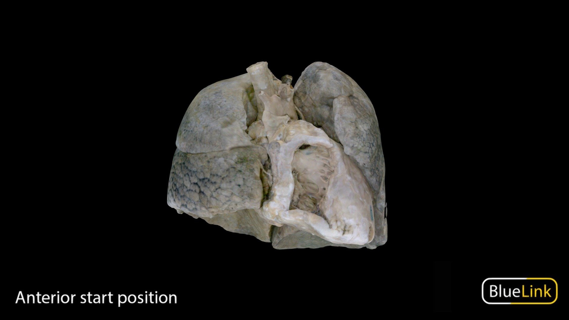 Human cardiopulmonary system

Captured with: EinScan 

Captured &amp; Edited by: Cristina Prall

University of Michigan

28424-C03 - Lungs with heart - 3D model by Bluelink Anatomy - University of Michigan (@bluelinkanatomy) 3d model