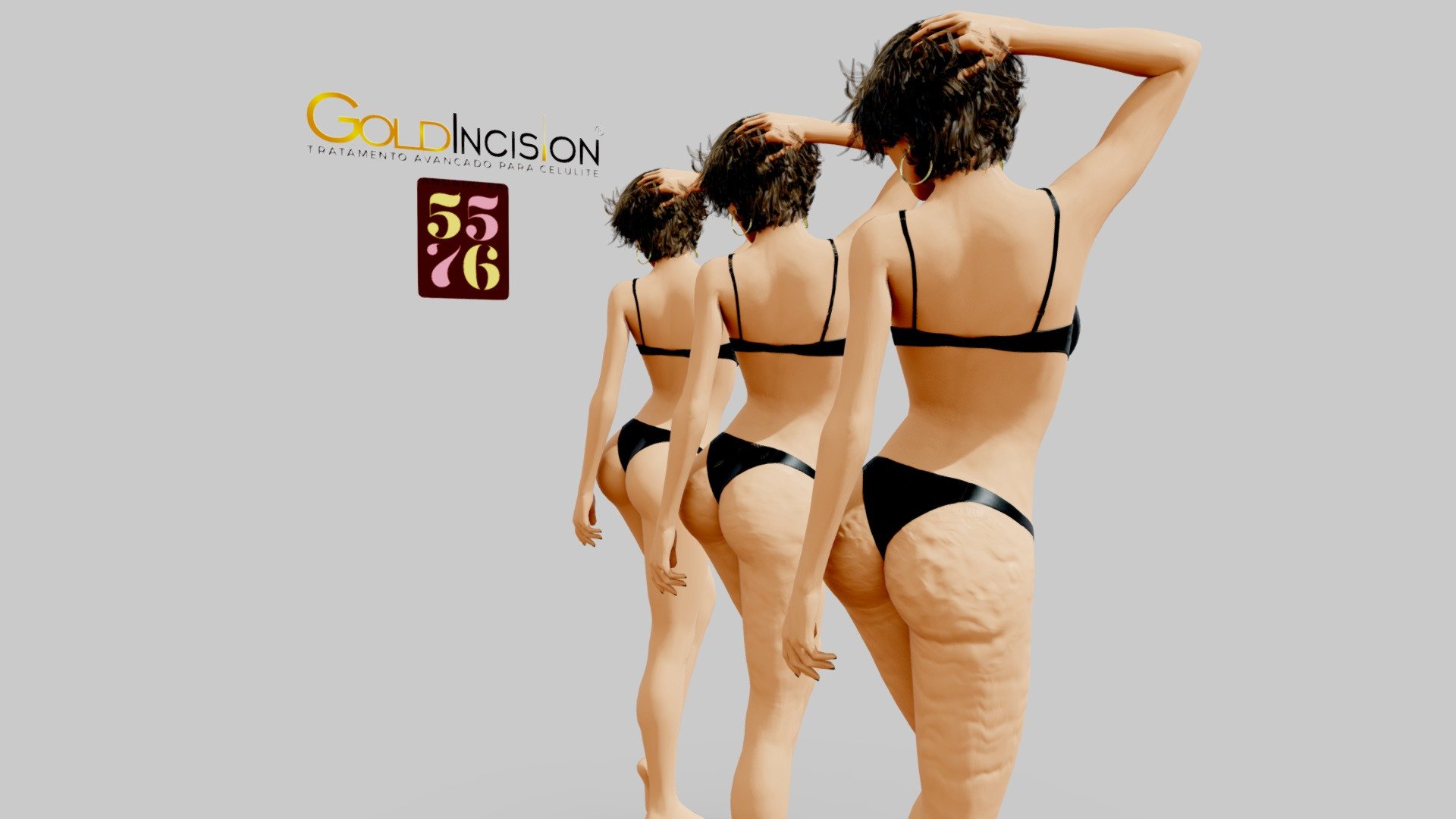 Comparação da aparencia do corpo após processo exclusivo da Goldincision - Goldincision - Comparação - 3D model by 5576 3d model