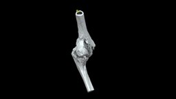 L. Elbow with Traumatic Fusion (VCU_3D_5443) humerus, pathology, osteology, ulna, human-anatomy, elbow, paleopathology, ankylosis, human-osteology, americancivilwar