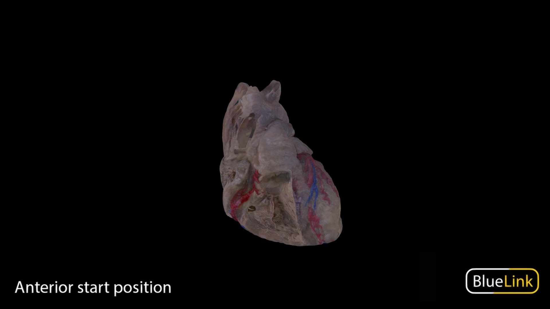 Human heart showing internal and external features
Captured with: EinScan Pro
Captured by: Will Gribbin
Edited by: Cristina Prall
University of Michigan
30279-C01 - Heart - Atria, Ventricles and Vasculature - 3D model by Bluelink Anatomy - University of Michigan (@bluelinkanatomy) 3d model
