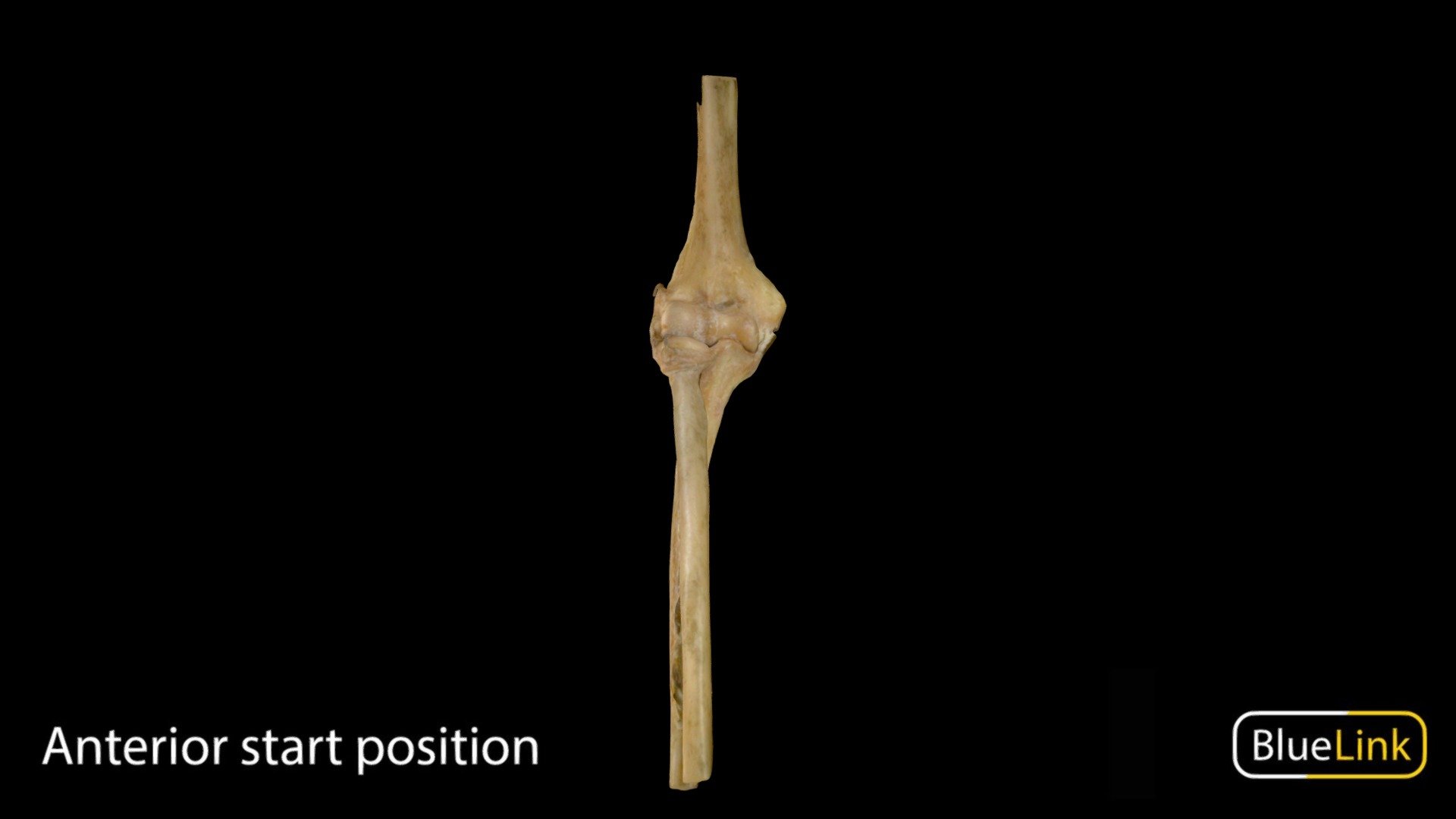 Human elbow joint

Captured with: EinScan Pro

Captured and edited by: Cristina Prall

University of Michigan

25548-U02 - Elbow Joint - 3D model by Bluelink Anatomy - University of Michigan (@bluelinkanatomy) 3d model