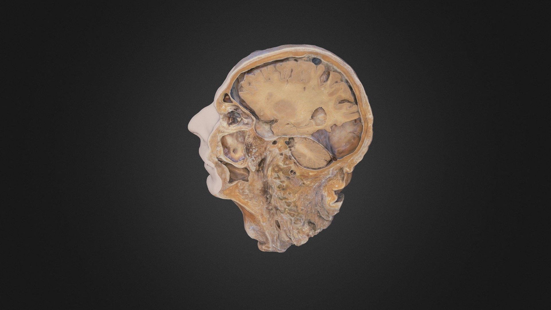 A plastinated midsagittal section of the head. 

For more on the head and neck, visit: https://clinicalanatomy.ca/head.html

Produced by UBC HIVE using Reality Capture and Artec Studio 13.

Credits:




Dr. Claudia Krebs (Faculty Lead) 


Photogrammetry: Connor Dunne

Laser scanning: Ishan Dixit
 - Midsagittal Section of Human Head - 3D model by UBC Medicine - Educational Media 3d model