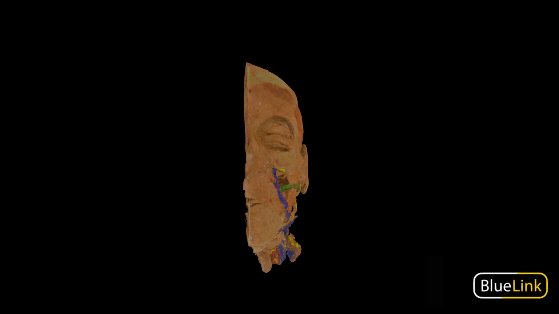 3D scan of a hemisected human head
Captured with EinScan Pro
University of Michigan
Captured and edited by: Cristina Prall &amp; Will Gribbin
31913-H02 - Muscles of Mastication - 3D model by Bluelink Anatomy - University of Michigan (@bluelinkanatomy) 3d model