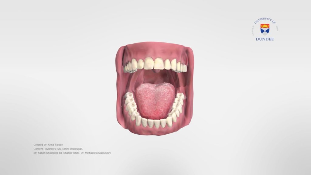This model was created as part of an online resource for dentistry students on oral cancer 3d model