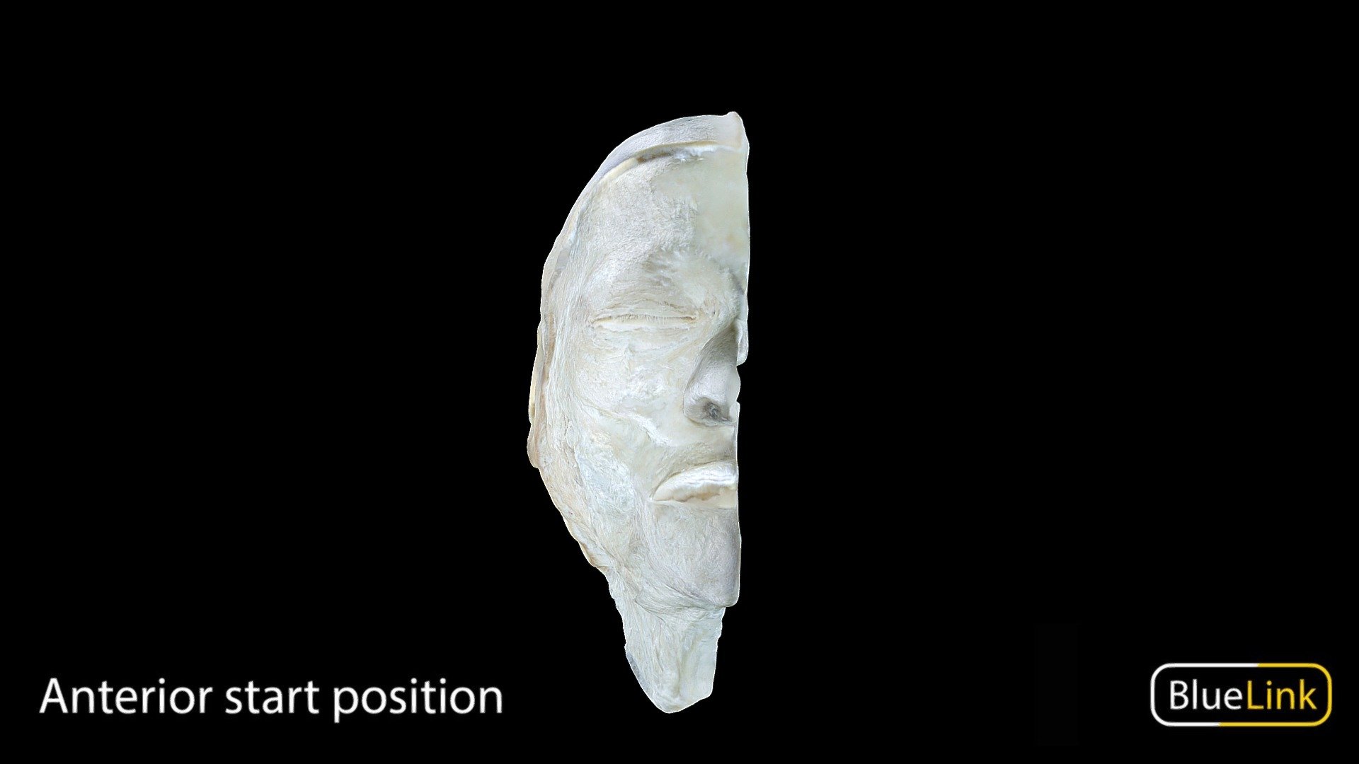 Model of the right side of a hemisected Head and Neck

Captured with photogrammetry

Captured and edited by: Nour Madani

Copyright 2023 BK Alsup &amp; GM Fox

90001-H03 - Head and Neck Hemisected Right - 3D model by Bluelink Anatomy - University of Michigan (@bluelinkanatomy) 3d model