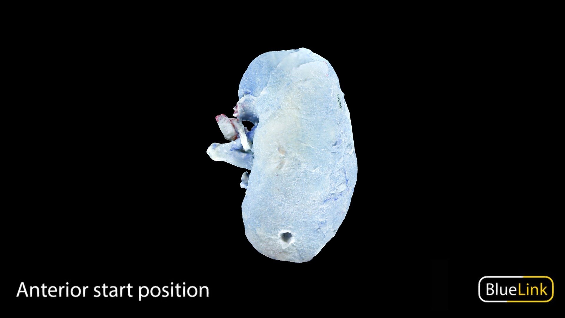 Bisected Human Kidney- Left

Captured using photogrammetry

Captured and edited by: Nour Madani

Copyright2022 BK Alsup &amp; GM Fox

[31370-A02] - Bisected Blue Colored Kidney - Left - Download Free 3D model by Bluelink Anatomy - University of Michigan (@bluelinkanatomy) 3d model