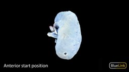 Bisected Blue Colored Kidney