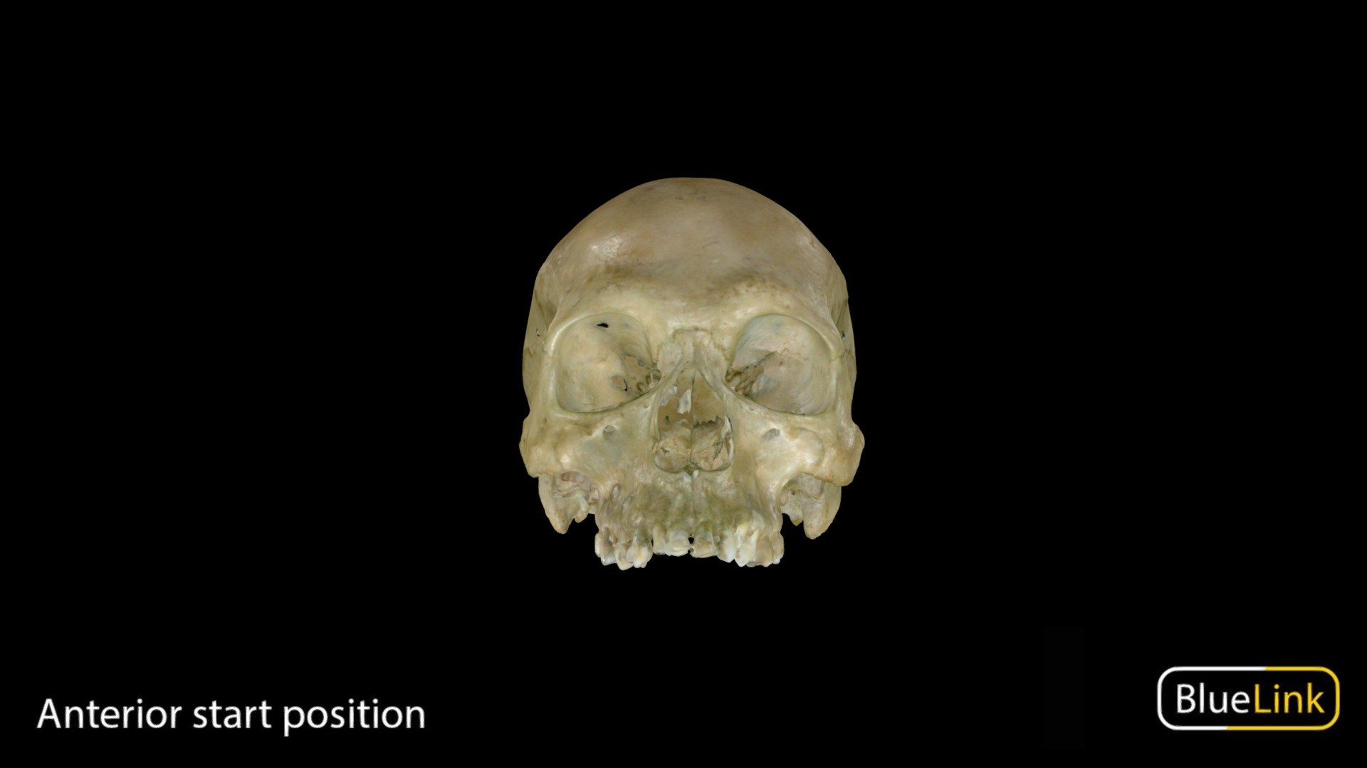 Human Cranium

Captured with: Einscan Pro

Captured and Edited by: Cristina Prall

University of Michigan

CC B. Kathleen Alsup and Glenn M. Fox - Cranium - 3D model by Bluelink Anatomy - University of Michigan (@bluelinkanatomy) 3d model