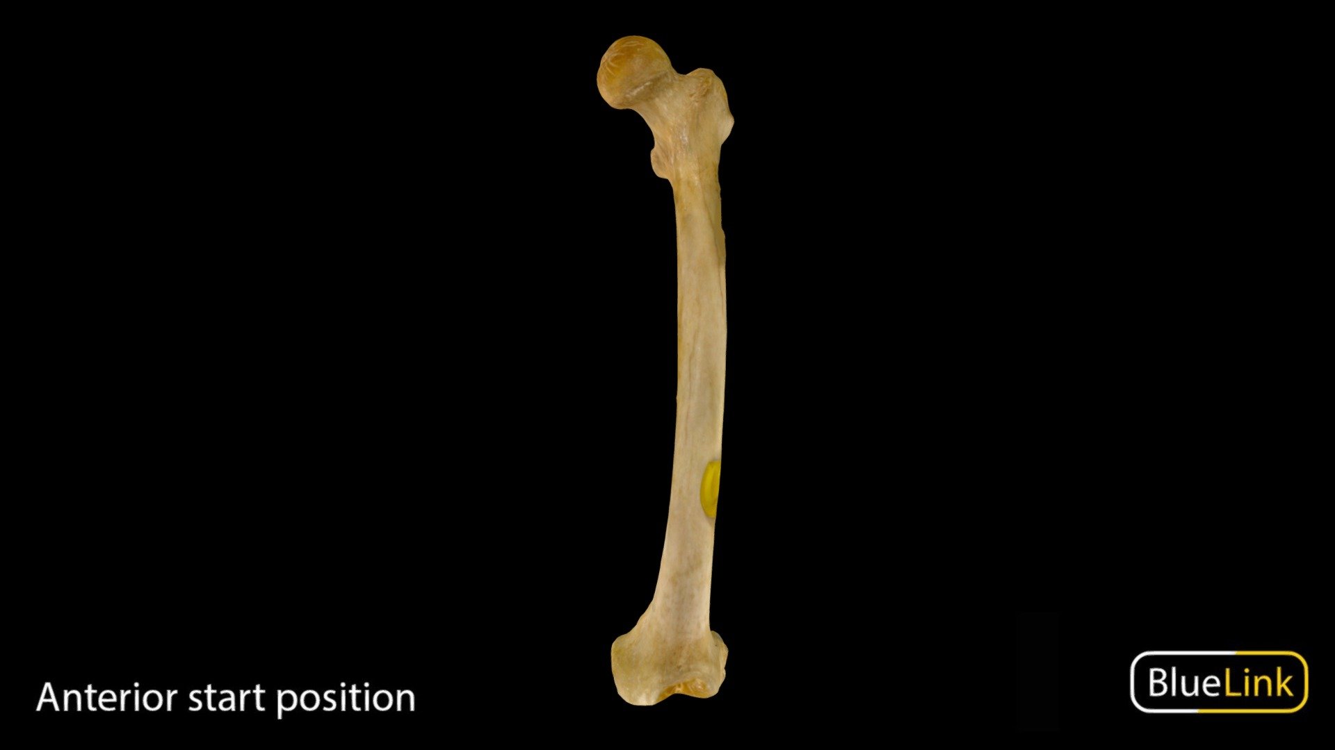 Human femur

Captured with: EinScan Pro

Captured and edited by: Cristina Prall

University of Michigan - Femur - 3D model by Bluelink Anatomy - University of Michigan (@bluelinkanatomy) 3d model