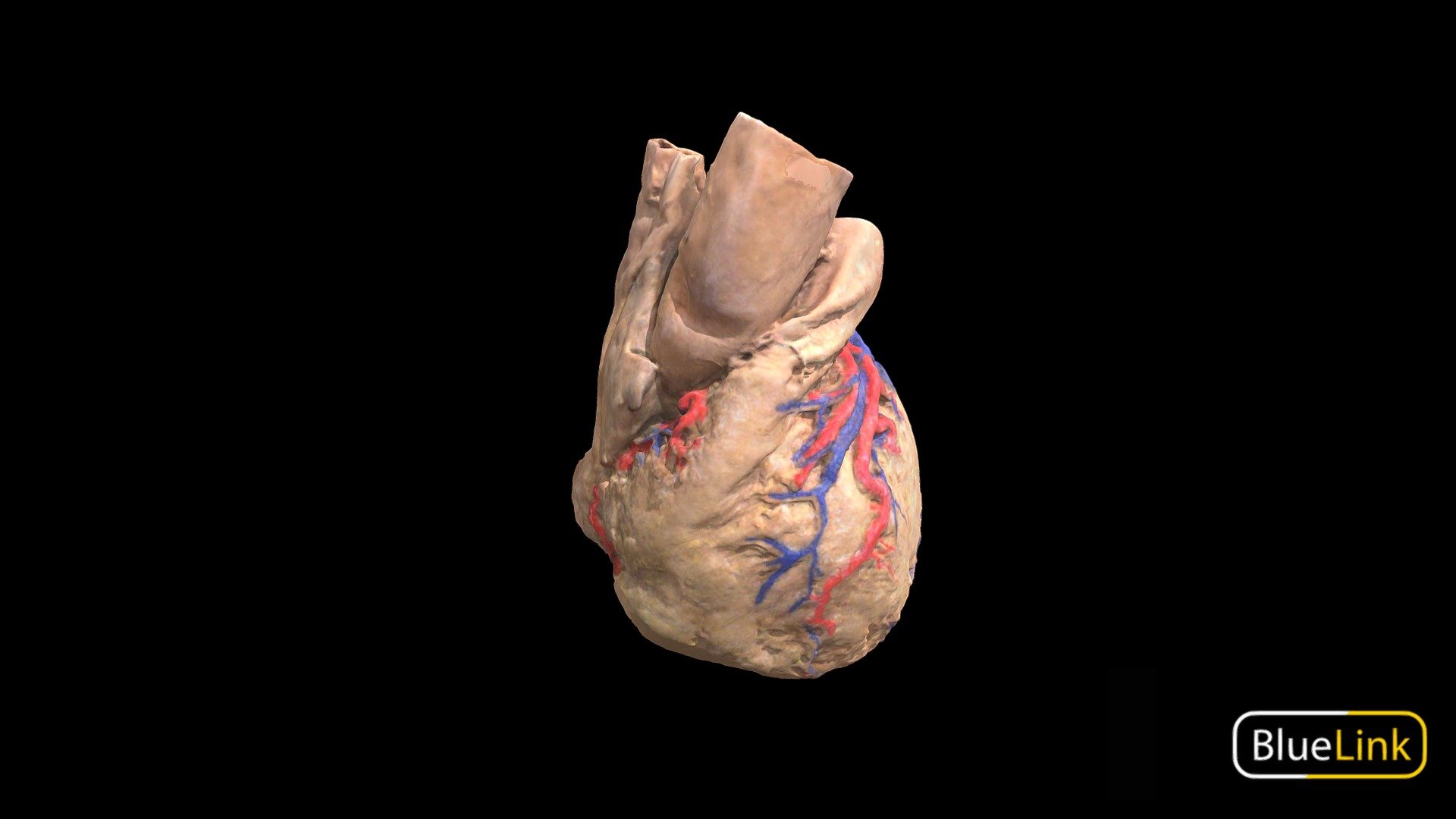 3D scan depicting the vascular supply of the human heart
Captured with: Einscan Pro
Captured by: Will Gribbin
Edited by: Cristina Prall
University of Michigan
21905-C01 - External Heart Vasculature - 3D model by Bluelink Anatomy - University of Michigan (@bluelinkanatomy) 3d model
