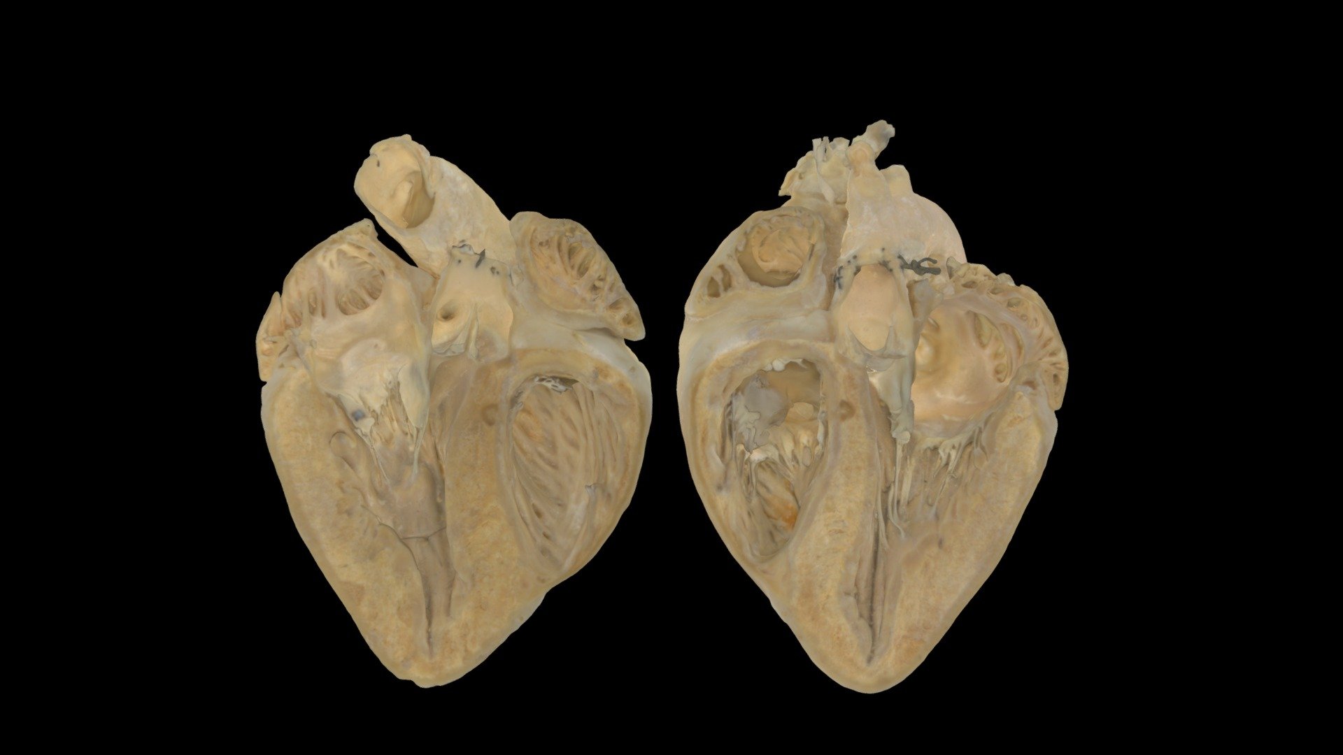 A plastinated Porcine (pig) heart cut coronally to form a posterior half (right) and an anterior half (left).

To learn more about cardiac anatomy, visit the Atlas of Human Cardiac Anatomy - Porcine Heart Anatomical Plane #0001 - Download Free 3D model by VisibleHeartLabs 3d model