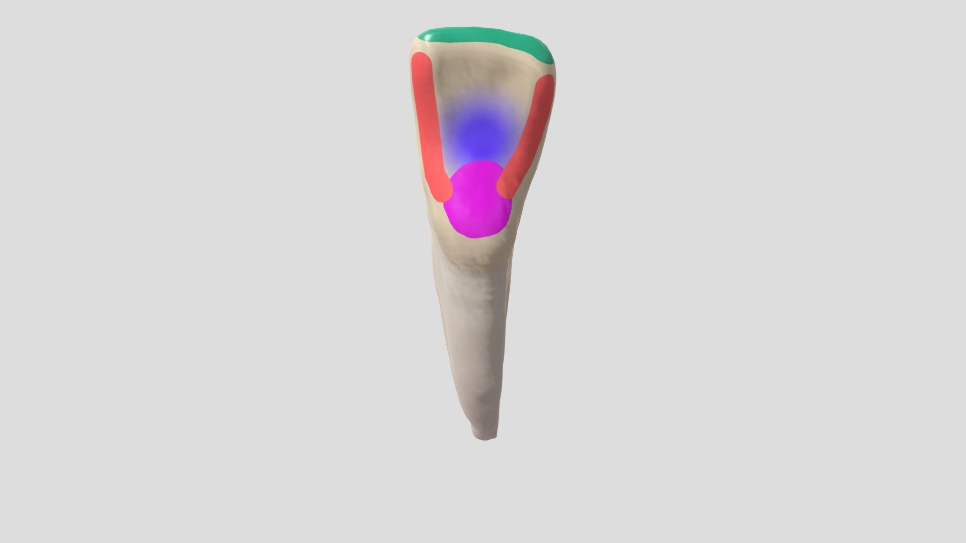Model courtesy of:  Anantomy Next, Visual Guide to Dental Anatomy - 3D. 
Color codes:Green = Incisal edge;
Pink = Ridges;
Purple = Fossas;
Fusha = Cingulum 3d model