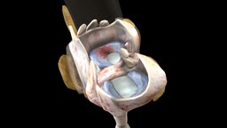 Lateral Meniscus: Radial Tear