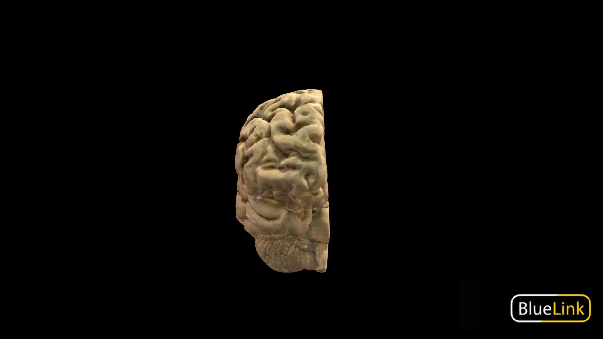3D scan of the right side of a hemisected brain 

Captured with Einscan Pro

Captured and edited by: Madelyn Murphy

Copyright2019 BK Alsup &amp; GM Fox - Brain - Right, Hemisected - 3D model by Bluelink Anatomy - University of Michigan (@bluelinkanatomy) 3d model