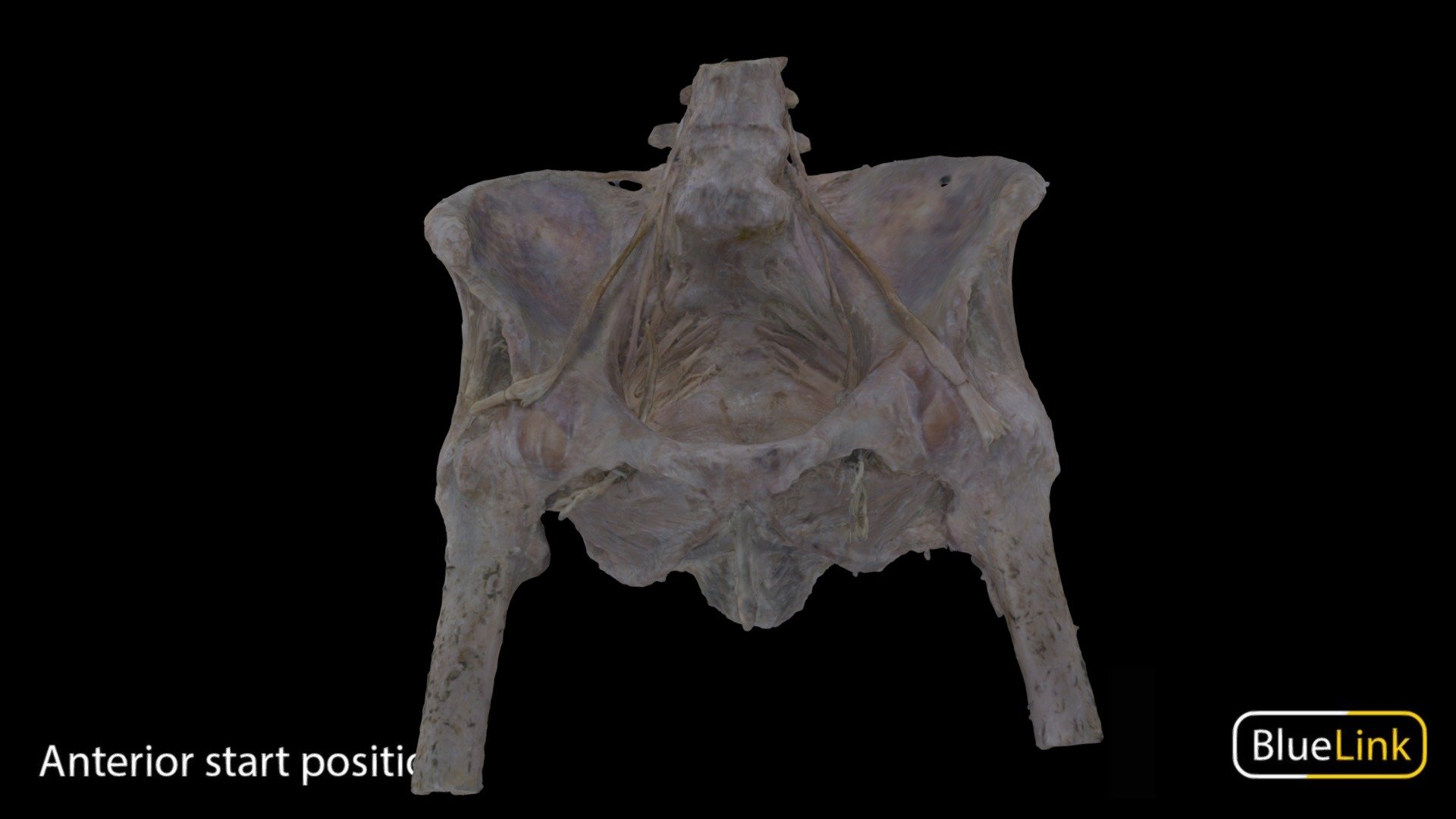 Human pelvis - female
Depicts: Piriformis m., sciatic n., pudendal neurovasculaure, isschioanal fossa, pelvic diaphragm, urogential hiatus, erectile tissue
Captured with: EinScan Pro
Captured by: Will Gribbin
Edited by: Cristina Prall
University of Michigan
30466-P01 - Female Pelvis - 3D model by Bluelink Anatomy - University of Michigan (@bluelinkanatomy) 3d model