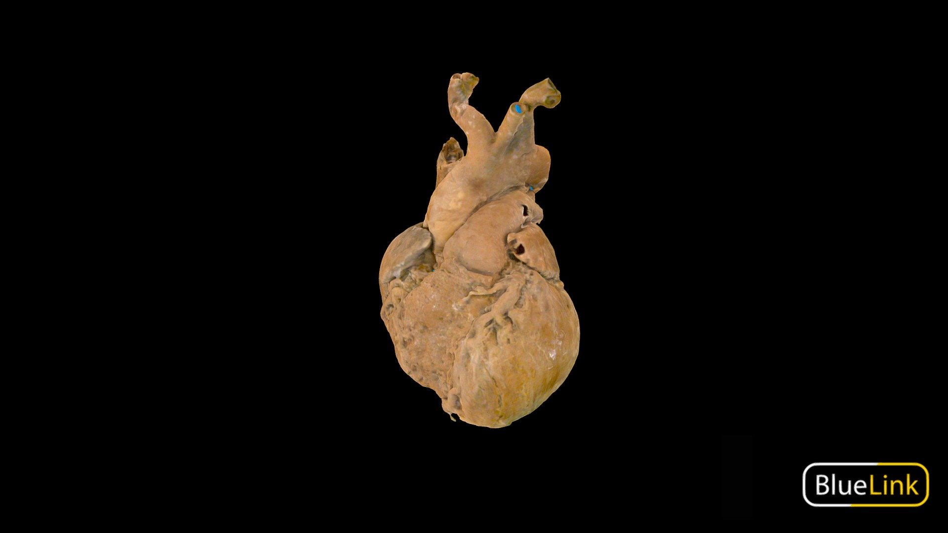 3D scan of a plastinated heart

Captured with Einscan Pro

Captured and edited by: Madelyn Murphy, Will Gribbin, Cristina Prall

Copyright 2019 BK Alsup &amp; GM Fox - Heart - Plastinated, Labeled - 3D model by Bluelink Anatomy - University of Michigan (@bluelinkanatomy) 3d model