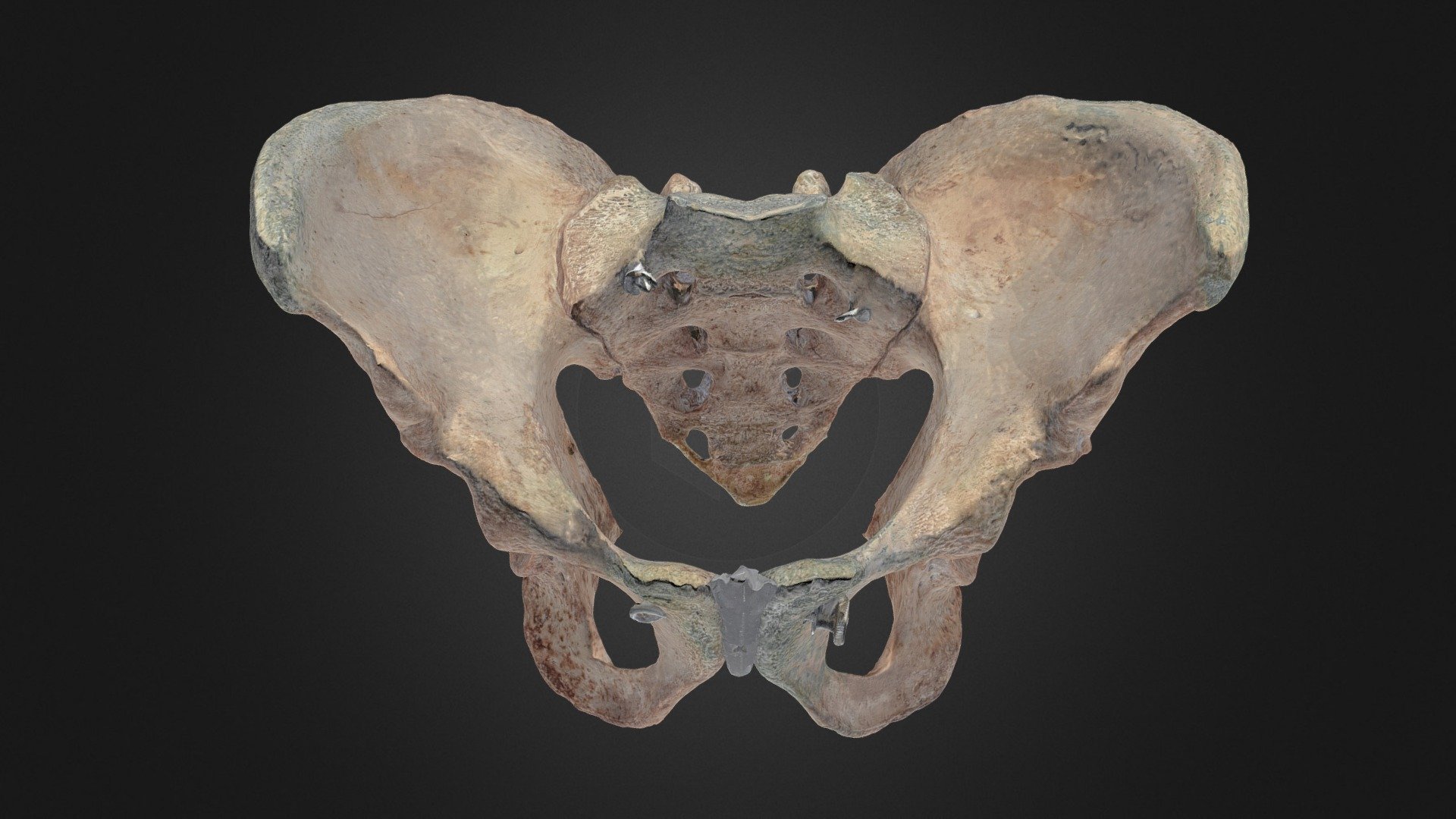 An android human pelvis. 

For more on the pelvis, visit: https://clinicalanatomy.ca/pelvis.html

Produced by the HIVE at the University of British Columbia.


Credits:
Dr. Claudia Krebs (Faculty Lead) 

Connor Dunne
Ishan Dixit
Monika Fejtek
 - Android Pelvis - 3D model by UBC Medicine - Educational Media 3d model