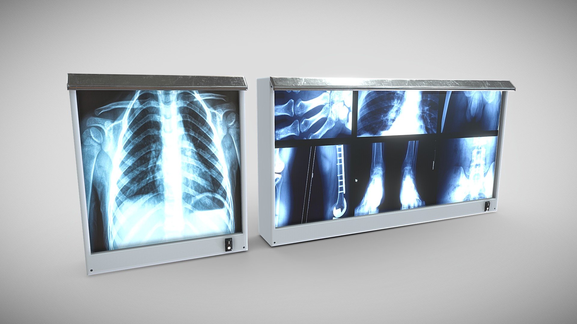 Pair of xray screens.  Useful prop for any sort of hospital/medical environment. 

PBR texrtures @4k - xray screens - Buy Royalty Free 3D model by Sousinho 3d model