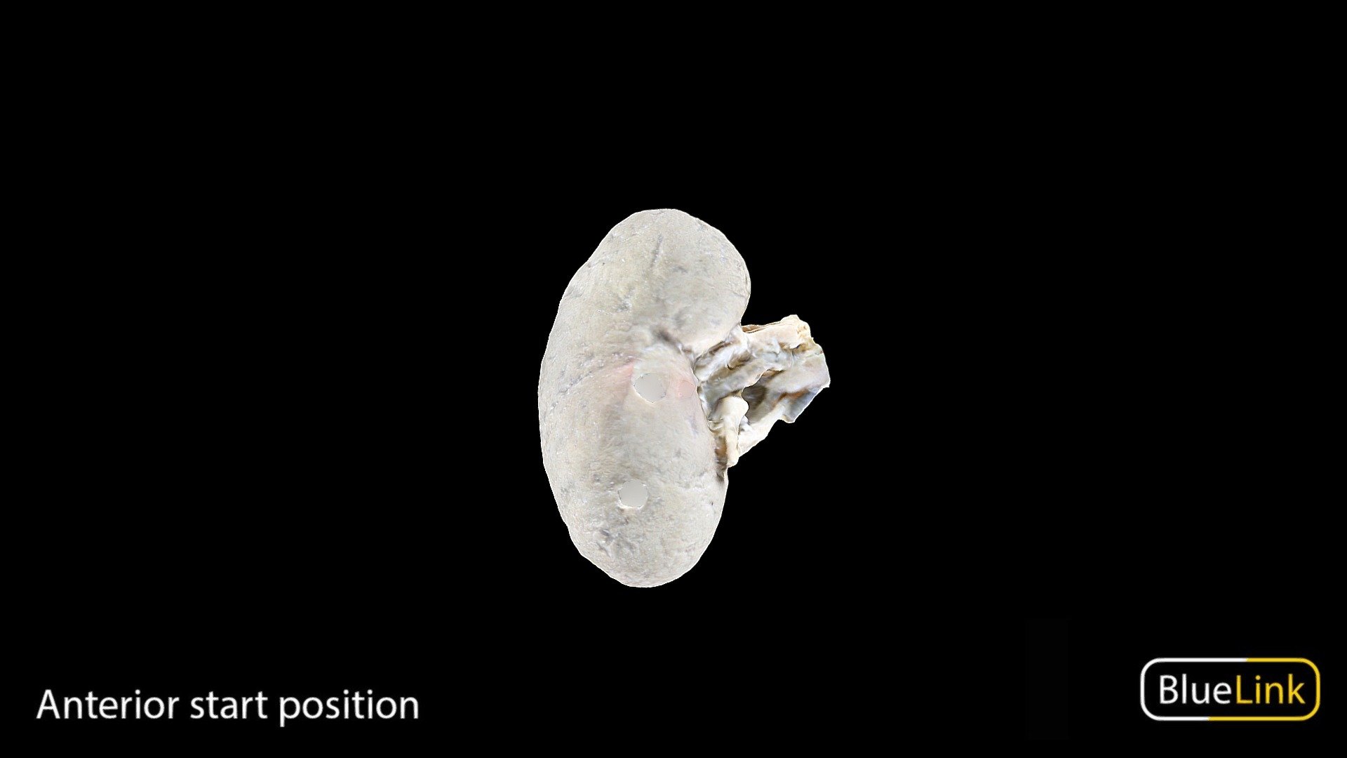 Whole Kidney
Captured using photogrammetry
Captured and edited by: Julia Egnaczyk
Copyright 2022 BK Alsup &amp; GM Fox
27969-A03 - Whole Kidney - 3D model by Bluelink Anatomy - University of Michigan (@bluelinkanatomy) 3d model