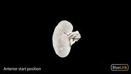 Whole Kidney anatomy, medicine, dissection, kidney, university-of-michigan, renal