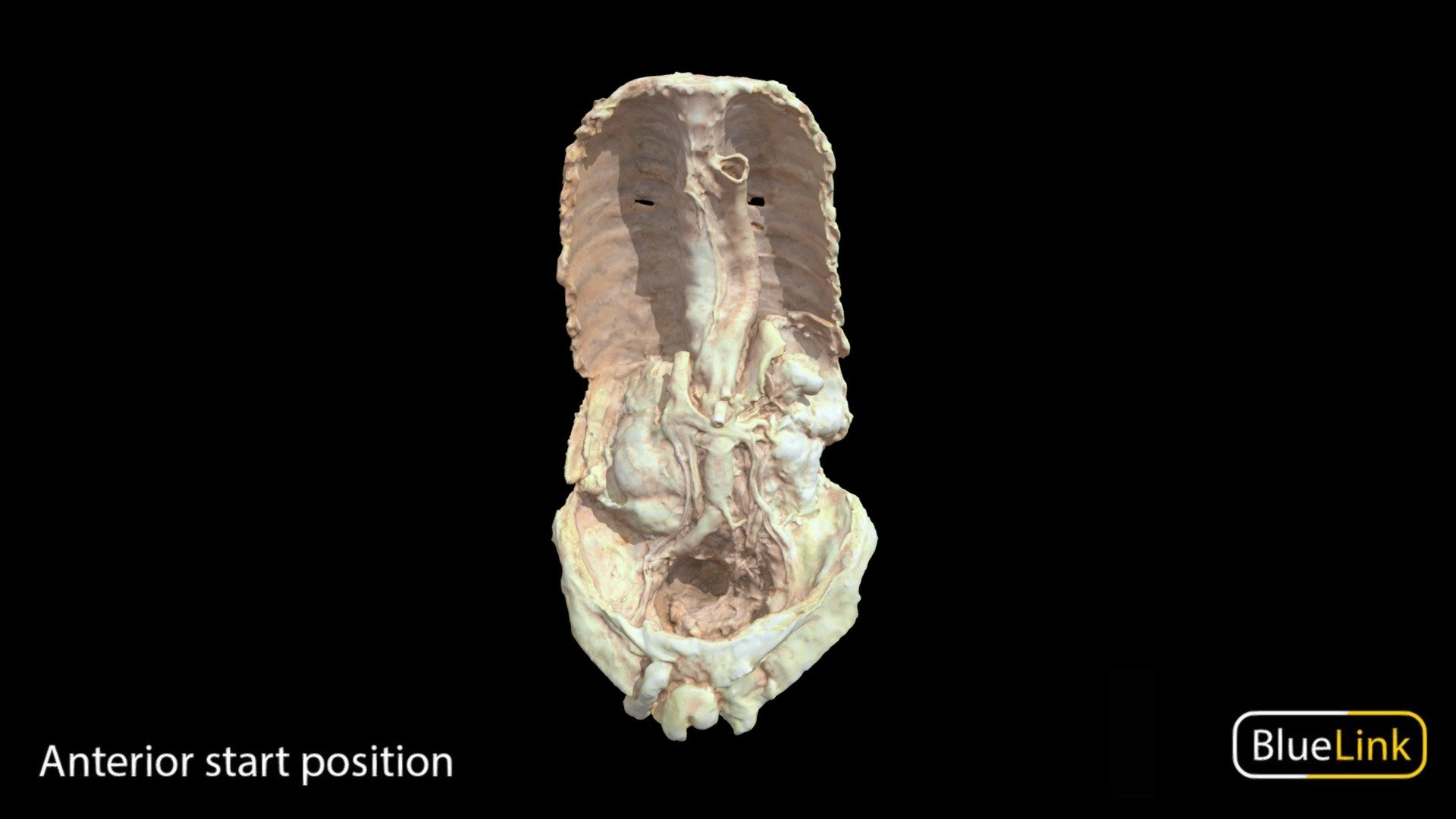 3D scan of a human abdomen showcasing the abdominal aorta
Captured with: Einscan Pro
Captured by: Will Gribbin
Edited by: Cristina Prall
University of Michigan
28877-T01 - Abdominal Aorta - 3D model by Bluelink Anatomy - University of Michigan (@bluelinkanatomy) 3d model