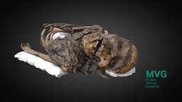 MVG-002- Cráneo y torso momificados