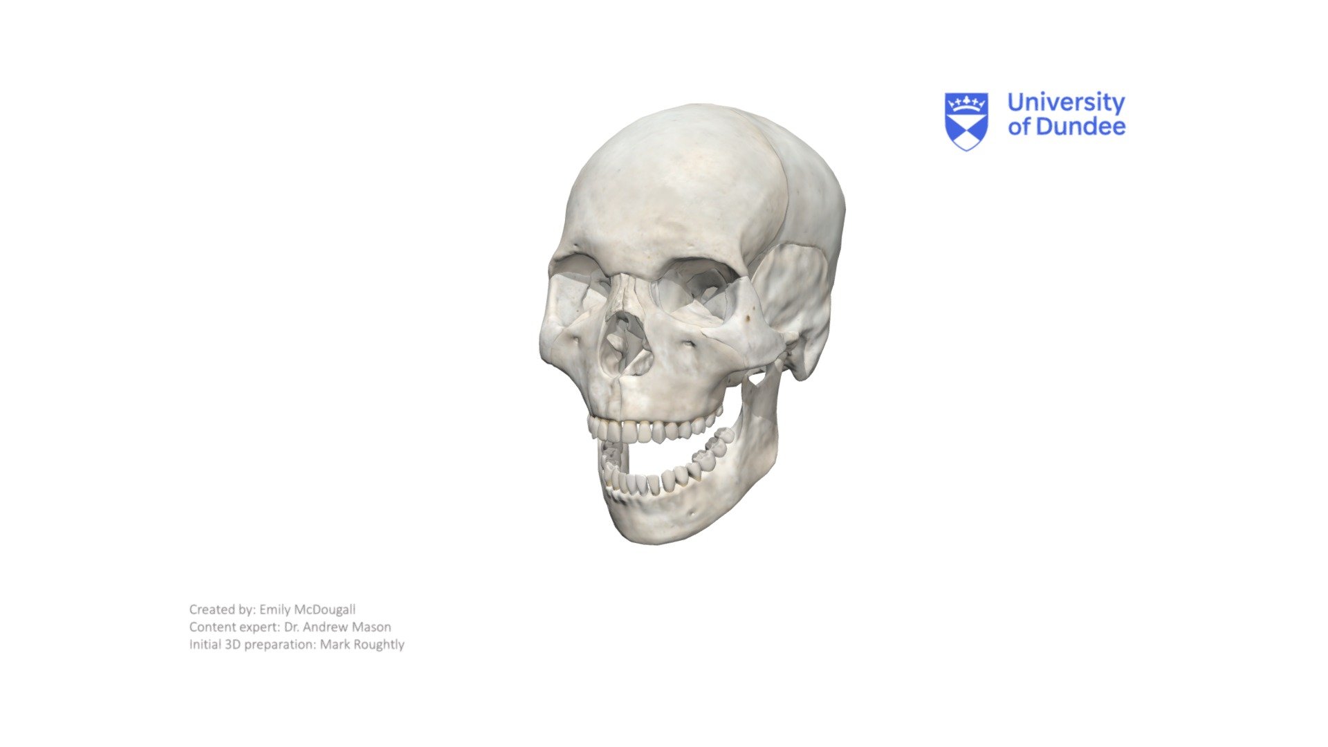 The Articular Disc of the Temporomandibular Joint.

Created by The University of Dundee, School of Dentistry - Articular Disc (TMJ) - Download Free 3D model by University of Dundee, School of Dentistry (@DundeeDental) 3d model