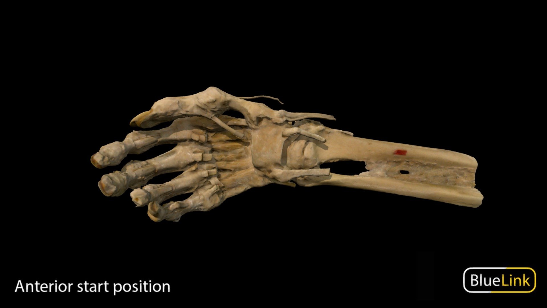 A 3D scan of a human distal forearm showcasing the carpal tunnel and interossi muscles. 

Captured with Einscan Pro

Carpal Tunnel reconstructed with Meshmixer and Meshlab

Captured and edited by: Will Gribbin

Copyright2019 BK Alsup &amp; GM Fox

ID 91042-U10 - Carpal Tunnel - 3D model by Bluelink Anatomy - University of Michigan (@bluelinkanatomy) 3d model