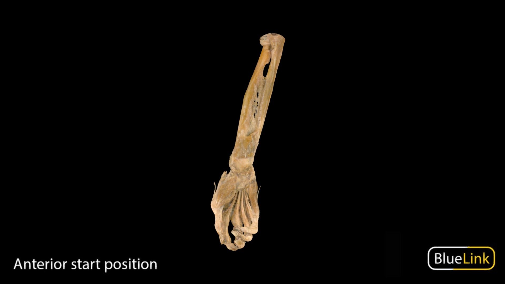 3D scan of the the right forearm

Captured with Einscan Pro

Captured and edited by: Will Gribbin

Copyright2019 BK Alsup &amp; GM Fox

ID 25671-U06 - Right Arm Pronator Quadratus - 3D model by Bluelink Anatomy - University of Michigan (@bluelinkanatomy) 3d model