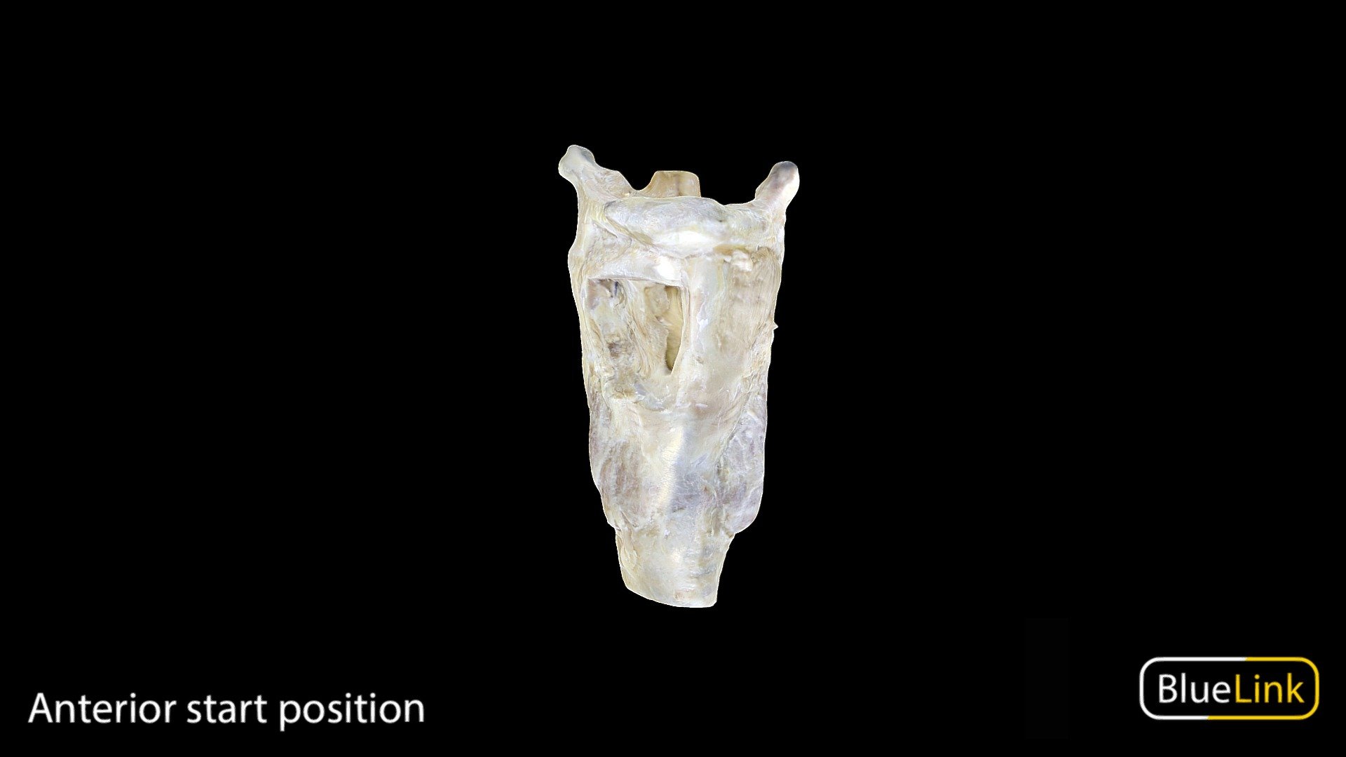 Model of a whole larynx

Captured with photogrammetry

Captured and edited by: Nour Madani

Copyright 2023 BK Alsup &amp; GM Fox

90244-H07 - Larynx - Download Free 3D model by Bluelink Anatomy - University of Michigan (@bluelinkanatomy) 3d model