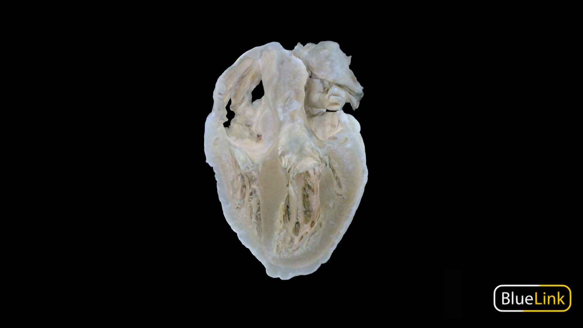 Hemisection of human heart 
Captured with: Einscan Pro
Captured by: Will Gribbin
Edited by: Cristina Prall
Univesity of Michigan
91008-C01 - Atria & Ventricles - Hemisection 2 - 3D model by Bluelink Anatomy - University of Michigan (@bluelinkanatomy) 3d model