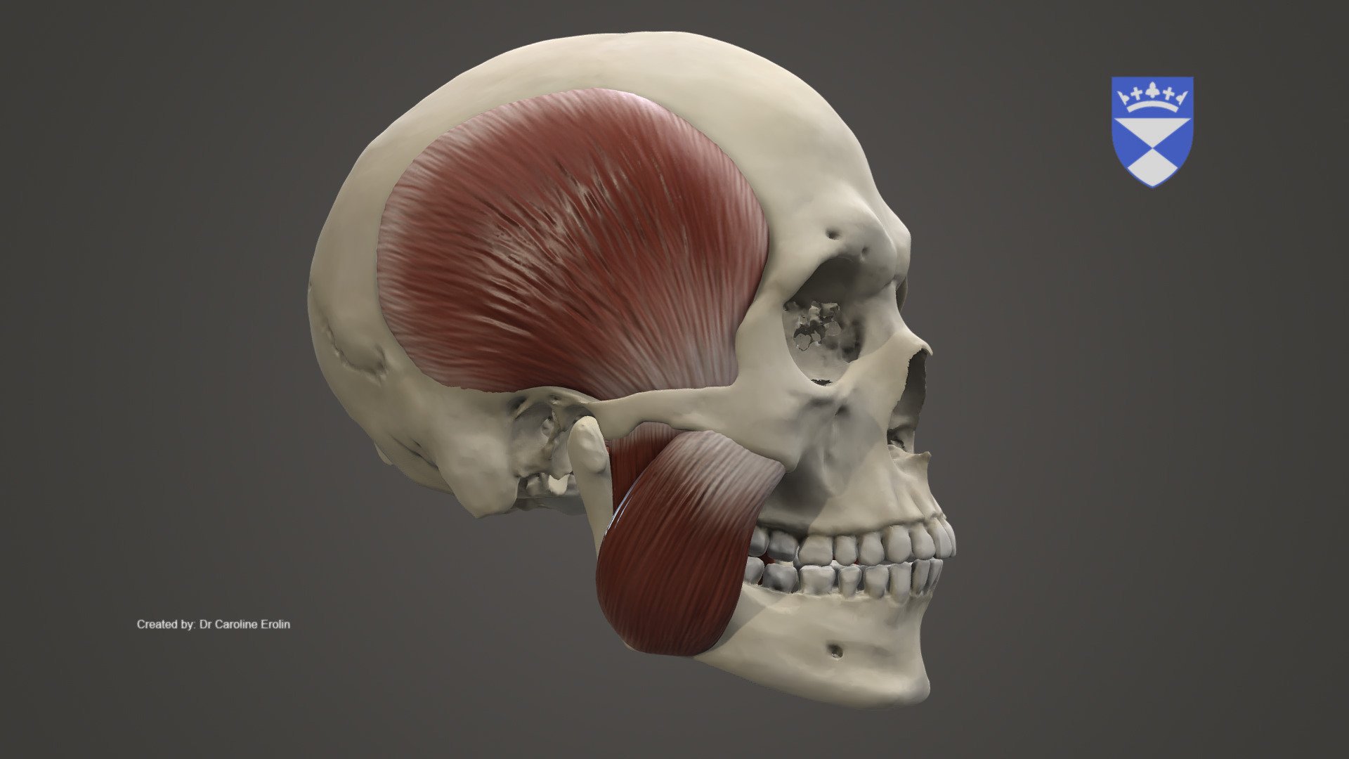 Model demonstrating the muscles of mastication. 

The skull is based on a microCT scan by the author while the muscles were sculpted in Zbrsuh. Texture added in Zbrush 3d model
